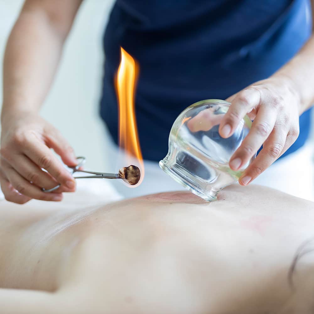 Shiatsu 3 Traditionelles Schroepfen mit Katharina Pinos von pinos.fit